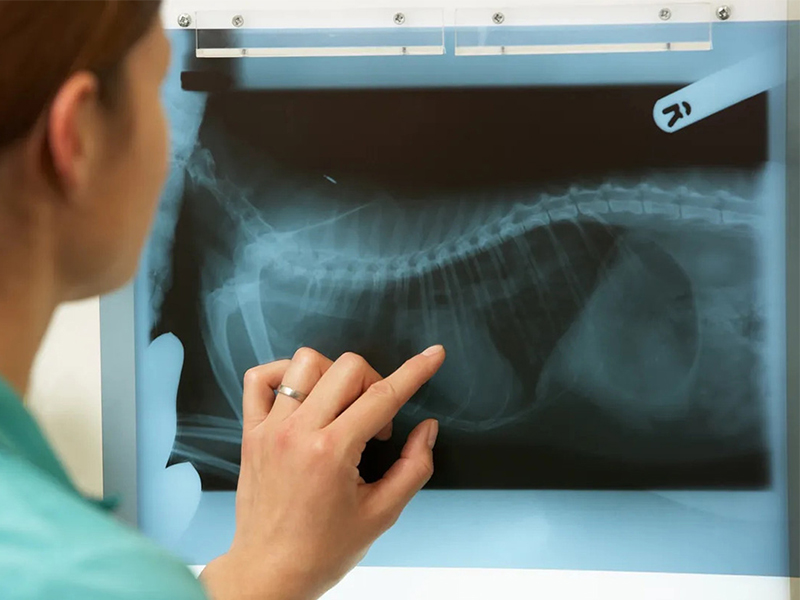 a person pointing at x-ray